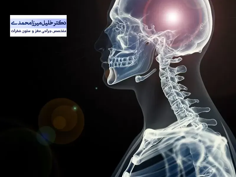 قاعده جمجمه چیست