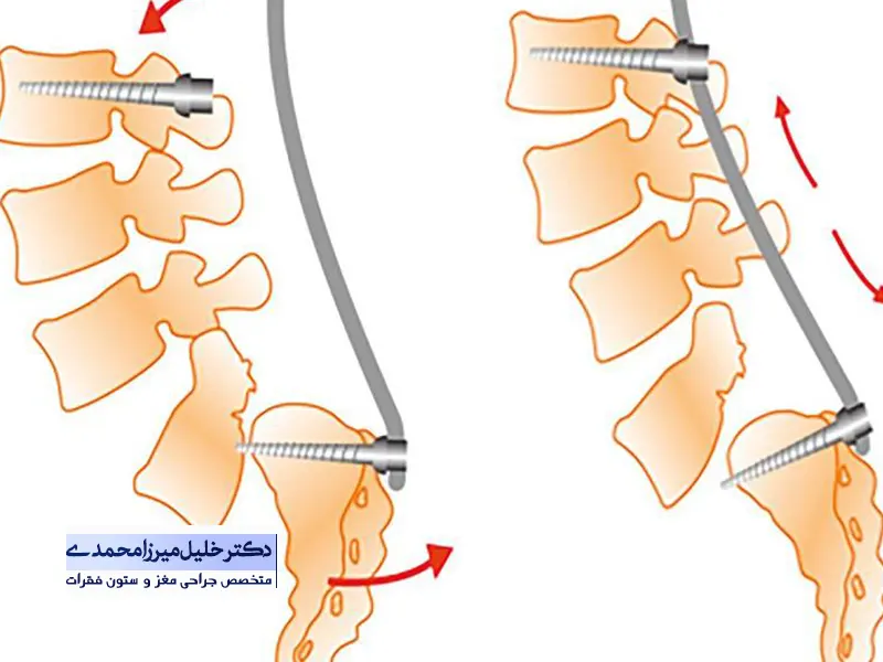 بهترین دکتر مغز و اعصاب