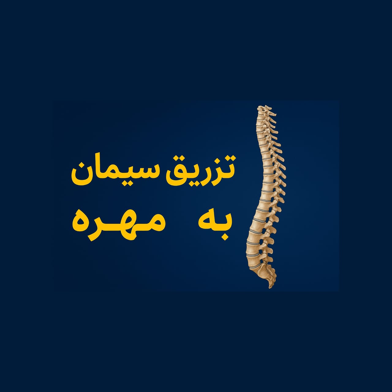 تزریق سیمان به مهره (ورتبروپلاستی و کیفوپلاستی) – تجربه دکتر خلیل میرزا محمدی